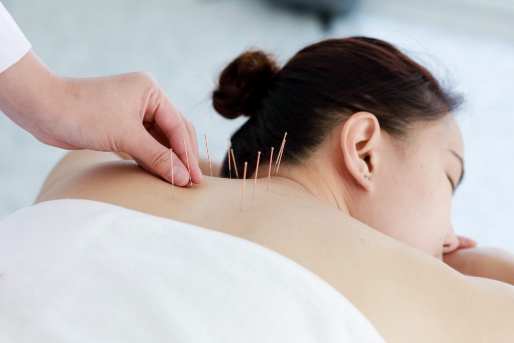 Acupuncture & Traditional Wellness Program